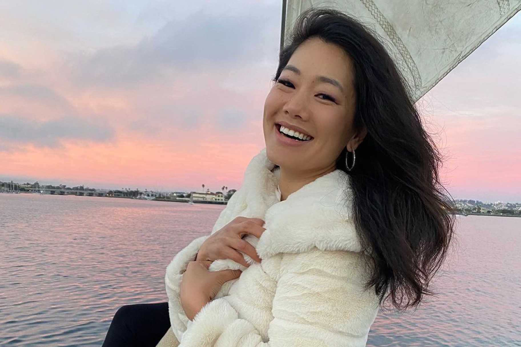 Crystal Kung Minkoff Says if She's Had Lip Fillers or Botox | Style