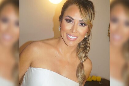 Kelly Dodd Facelift