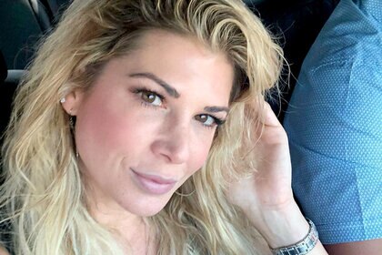 Alexis Bellino Black Eye Accident