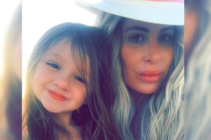 Kaia Kim Zolciak Biermann Broken Arm