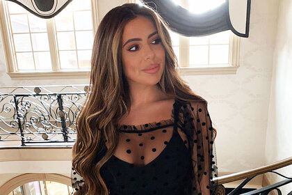 Brielle Biermann Lip Fillers