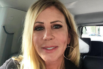 Vicki Gunvalson Allergic Reaction