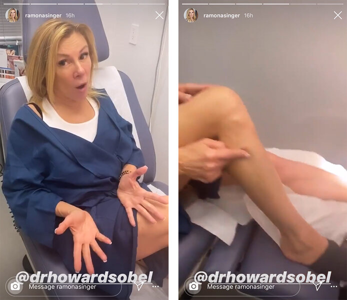 Ramona Singer Leg Procedure