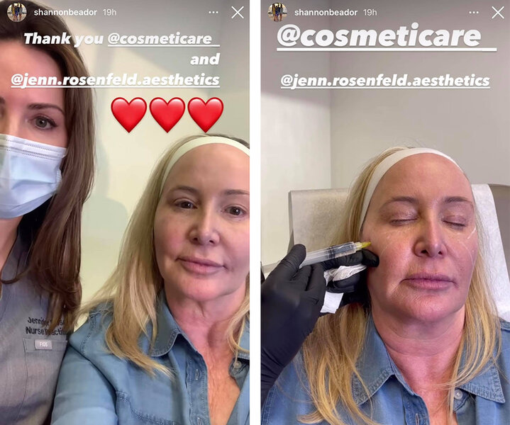 Shannon Beador's $2,500 Pre-Reunion CO2 Laser Facial: Details