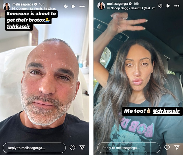 Melissa Gorga & Joe Get Botox Together on Date Night (PICS) | The Daily ...