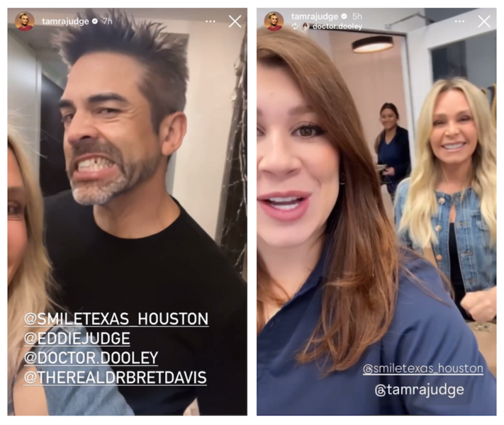 RHOC Tamra and Eddie Judge veneers