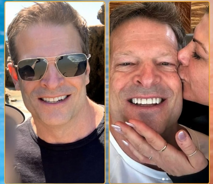 A plit of John Janssen before and after his dental implants